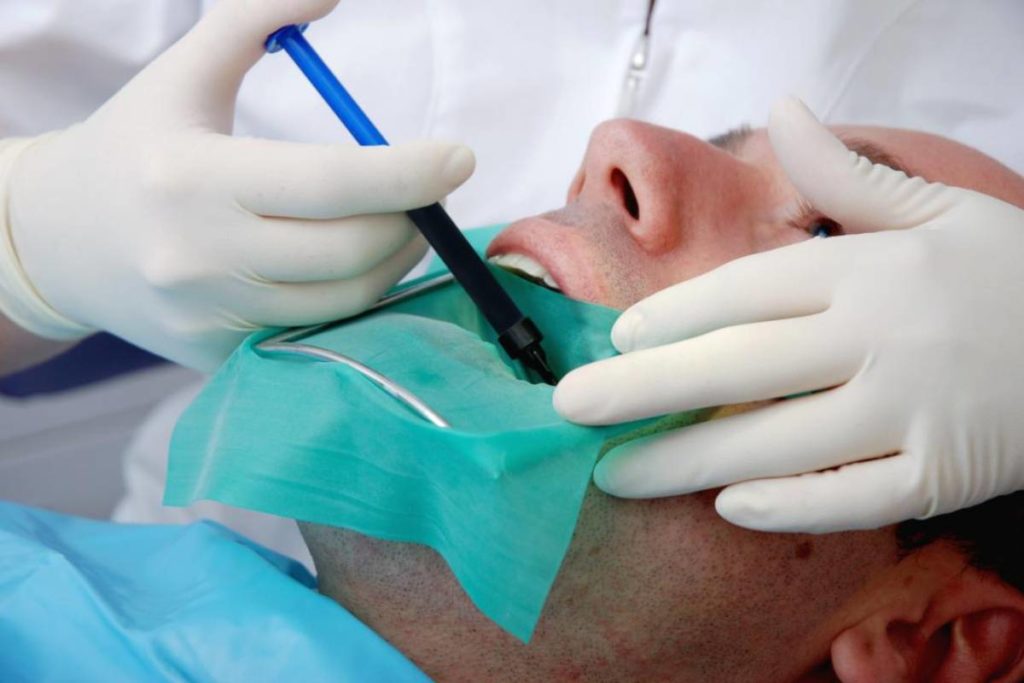 root canal treatment