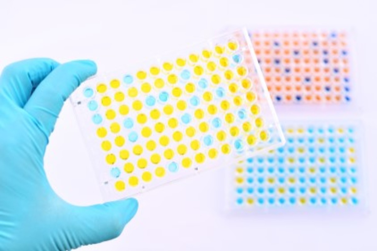 ELISA Tests and Their Mechanisms Explained