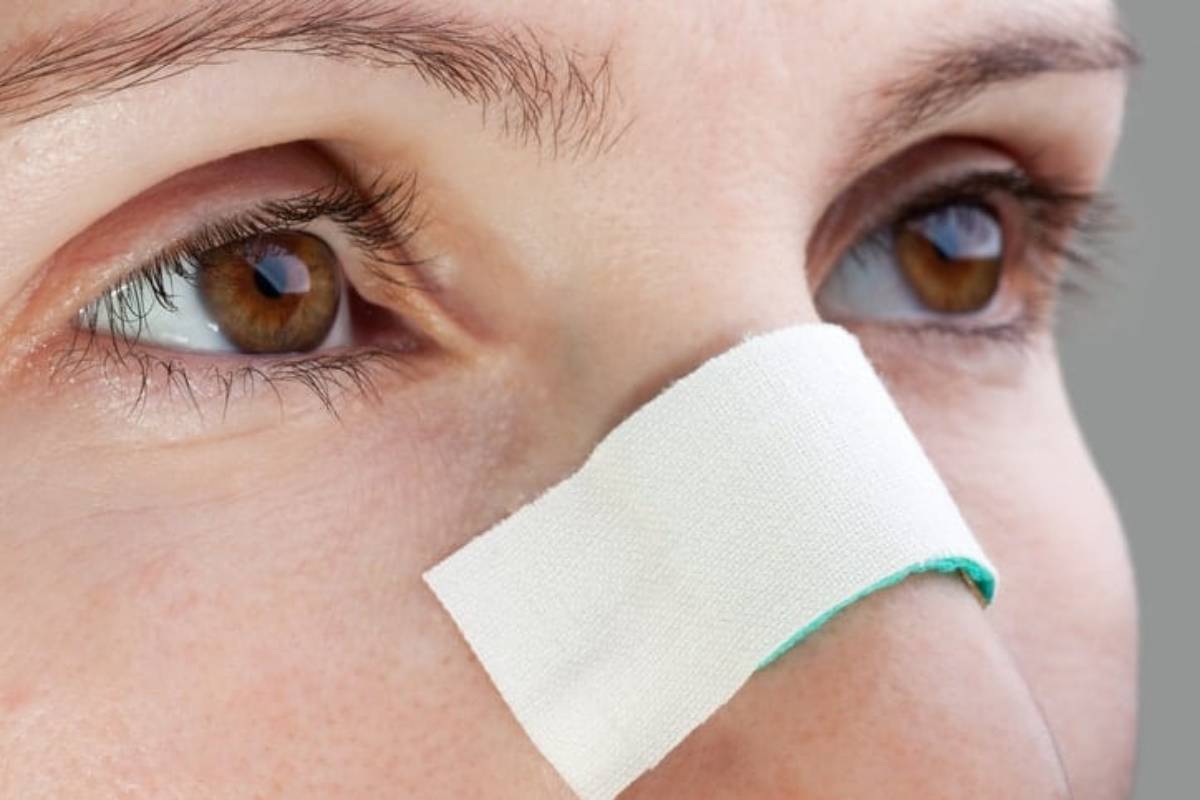 How Is a Fractured Nose Treated?