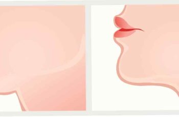How Facial Liposuction Can Make You Look Younger