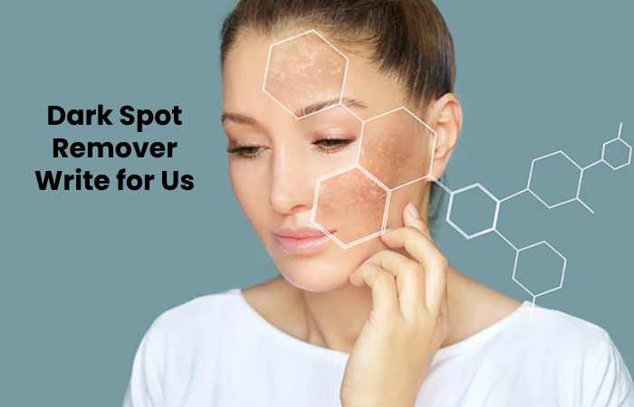 Integrating the Dark Spot Corrector into your skincare routine must be done in the right sequence so it complements the rest of your skin products and gives you a supple, luxurious face that's free from acne marks and dark pigmentations. Because you want the best results, here are 5 simple steps to fit the Dark Spot Corrector to your usual skincare regime: 1. Cleanse and Rinse Wet your neck and face, then apply either mild soap or a gentle cleanser. Use your fingertips to lather the soap or cleanser on your skin, but don't scrub your face in the process. 2. Stay Moisturized Spread a pea-size amount of light moisturizer on your face and neck while your skin is still slightly damp as this would help the product seal the moisture in your pores. You must use moisturizing products because some soaps and cleansers may dry the skin after you wash your face. Using moisturizers maintains the right amount of moisture on your skin to keep it soft and smooth. 3. Peel Off Dark Spots Press the pump of your Dark Spot Corrector once to dispense a pea-sized amount of serum onto your palm. Select the parts of your skin that contain dark spots and discoloration. Smooth the product over these dark and hyperpigmented areas while avoiding unaffected, normal skin. 4. Daub Some Essence Distribute 4 to 5 squirts of skincare essence onto your palms and press the product gently onto your skin. Apply only with light pats and don't rub or drag the essence across your face. 5. Protect Against The Sun Spread a water-resistant sunscreen or SPF foundation on your face and neck. It should have an SPF level of 30 or higher for better defense against sunburn and the sun's harmful UV rays. Once you've completed the list of aforementioned steps, you can finally apply the rest of your skincare products and cosmetics. How to Submit Your Article on Worldbeautytips.com for Dark Spot Remover Write For Us? To submit guest posts, please read the guidelines mentioned below. You can contact us at the website contact form or contact@worldbeautytips.com. Why Write for Worldbeautyips – Dark Spot Remover Write for Us Writing for Worldbeautytips can expose your website to customers looking for Dark Spot Remover. Worldbeautytips' presence is on Social media, and we will share your article with the Nail Health-related audience. You can reach out to Dark Spot Remover enthusiasts. Search Terms Related to Dark Spot Remover Write for Us Skin Smoker's Melanosis Contraceptives Hormone Replacement Therapy Addison's Disease Phototoxicity Nevus Of Ota Café Au Lait Macules Seborrheic Keratosis Poikiloderma Of Civatte Coeliac Disease Cronkhite Tinea Fungal Infections Ringworm. Haemochromatosis Mercury Poisoning Aromatase Deficiency Nelson's Syndrome Graves' Disease Hypopigmentation List Of Skin Conditions Drug-Induced Pigmentation Nails Search Terms for Dark Spot Remover Write for Us Dark Spot Remover Write for Us Dark Spot Remover Guest Post Submit an article Dark Spot Remover Contribute Guest Post Dark Spot Remover Dark Spot Remover Submit Post Dark Spot Remover submitted an article. Become a guest blogger at Dark Spot Remover Dark Spot Remover Write for us Contribute Dark Spot Remover Dark Spot Remover Submit post Submit an article Dark Spot Remover become a guest blogger Dark Spot Remover writers wanted Submit an article Dark Spot Remover suggests a post Contribute Dark Spot Remover Dark Spot Remover, guest author Article Guidelines on Worldbeautytips – Dark Spot Remover Write for Us We at Worldbeautytips welcome fresh and unique content related to Dark Spot Remover. Worldbeautytips allow a minimum of 500+ words related to Dark Spot Remover. The editorial team of Worldbeautytips does not encourage promotional content related to Dark Spot Remover. To publish an article at Worldbeautytips, please email us at contact@worldbeautytips.com Worldbeautytips allows articles related to fitness, trends, hair, etc. Related Pages Eye Liner Write For Us Hair Style Write For Us Retinol Write For Us Hair Conditioner Write For Us Nail Polish Write For Us Blow Dryer Write For Us 
