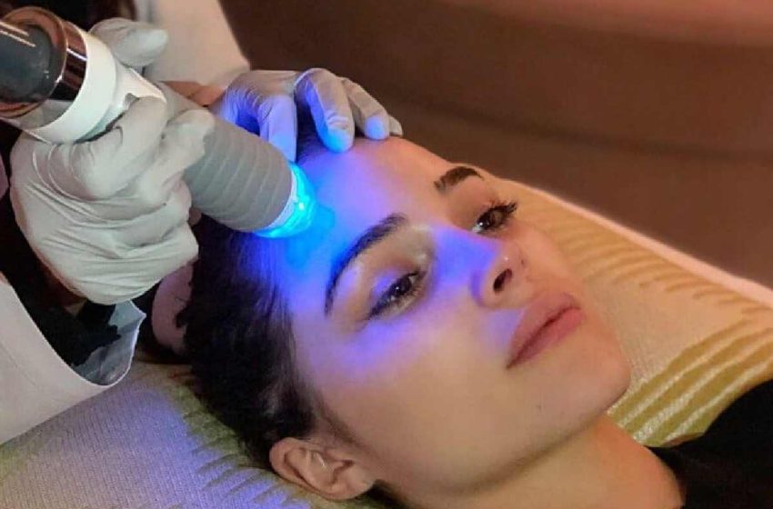  Understanding RF Microneedling