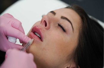 How to Find the Right Place for Lip Fillers in Las Vegas