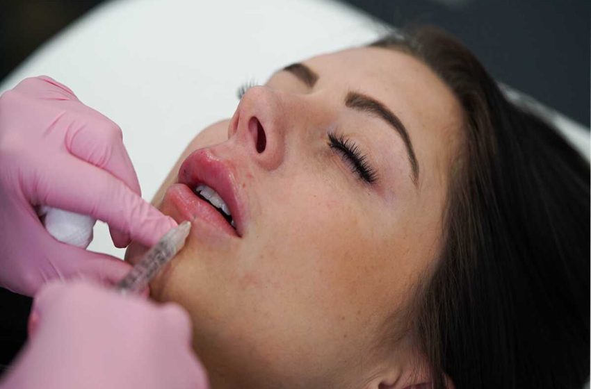 How to Find the Right Place for Lip Fillers in Las Vegas